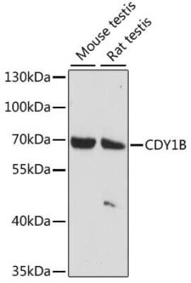 Western Blot: CDY1B AntibodyAzide and BSA Free [NBP3-05641]