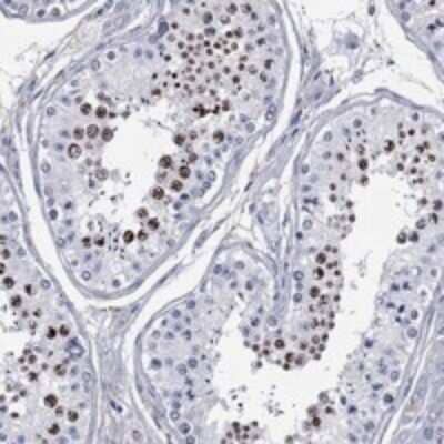 Immunohistochemistry-Paraffin: CDY2B Antibody [NBP3-17478]