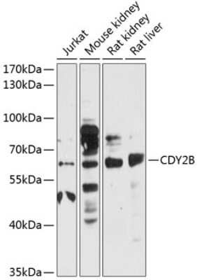 Western Blot: CDY2B AntibodyBSA Free [NBP3-05603]