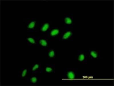 Immunocytochemistry/ Immunofluorescence: CDYL Antibody (1A6) [H00009425-M02]