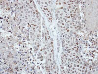 Immunohistochemistry-Paraffin: CDYL Antibody [NBP2-15851]