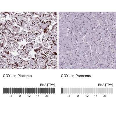 Immunohistochemistry-Paraffin: CDYL Antibody [NBP2-34011]