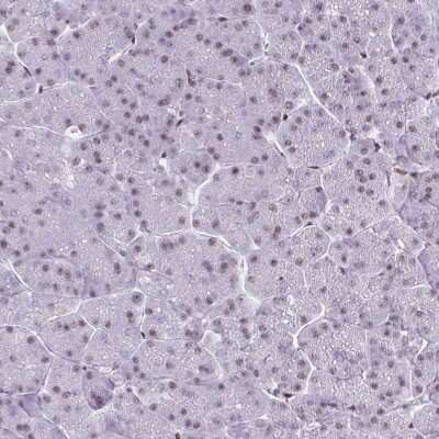 Immunohistochemistry-Paraffin: CDYL Antibody [NBP2-34011]