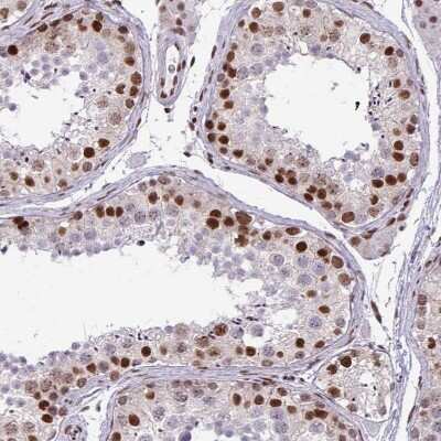 Immunohistochemistry-Paraffin: CDYL Antibody [NBP2-34011]