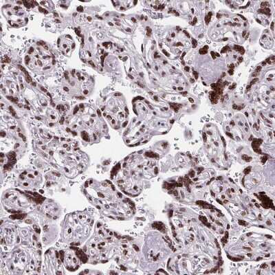 Immunohistochemistry-Paraffin: CDYL Antibody [NBP2-34011]