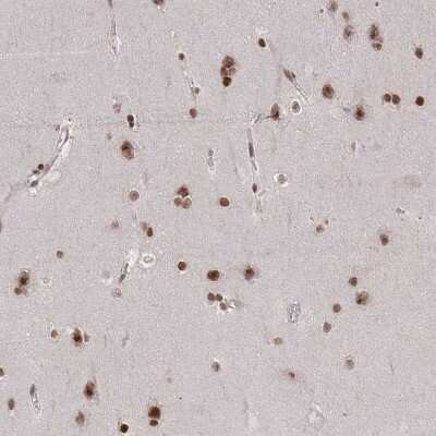 Immunohistochemistry-Paraffin: CDYL Antibody [NBP2-34011]