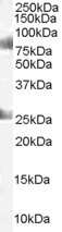 Western Blot: CDYL Antibody [NB300-874]