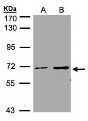 Western Blot: CDYL Antibody [NBP1-31036]