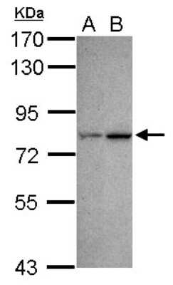 Western Blot: CDYL Antibody [NBP2-15851]