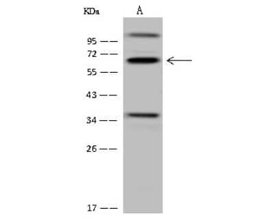 Western Blot: CDYL Antibody [NBP2-98669]