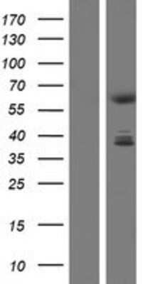 Western Blot: CDYL Overexpression Lysate [NBP2-05203]