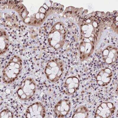 Immunohistochemistry: CDYL2 Antibody [NBP1-83470]