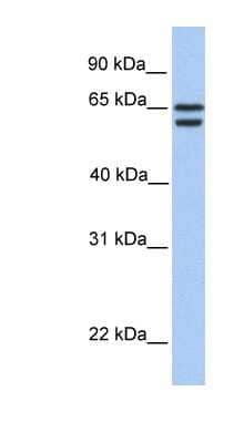 Western Blot: CDYL2 Antibody [NBP1-55178]