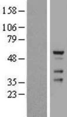 Western Blot: CDYL2 Overexpression Lysate [NBP2-05387]