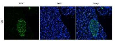 Immunocytochemistry/ Immunofluorescence: CEACAM5/CD66e Antibody (Arcitumomab) - Chimeric - Azide and BSA Free [NBP2-52673]