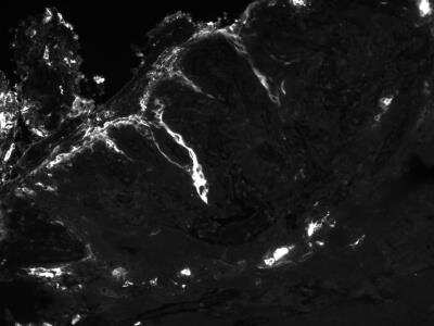 Immunohistochemistry-Paraffin: CEA Antibody (PARLAM 4) - BSA Free [NBP1-97718]