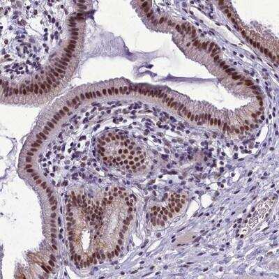 Immunohistochemistry: CEACAM19 Antibody [NBP2-14467]