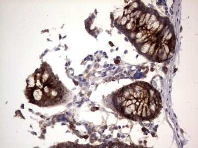 Immunohistochemistry: CEACAM5/CD66e Antibody (OTI3D8) [NBP2-46231]