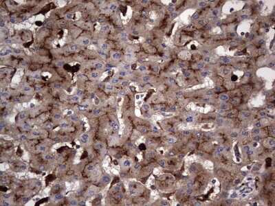 Immunohistochemistry: CEACAM5/CD66e Antibody (OTI3D8) [NBP2-46231]