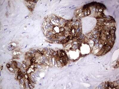 Immunohistochemistry: CEACAM5/CD66e Antibody (OTI3D8) [NBP2-46231]