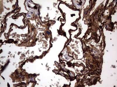 Immunohistochemistry: CEACAM5/CD66e Antibody (OTI3D8) [NBP2-46231]