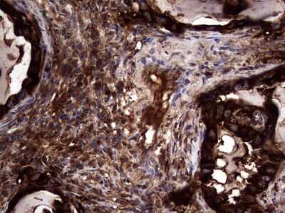 Immunohistochemistry: CEACAM5/CD66e Antibody (OTI3D8) [NBP2-46231]