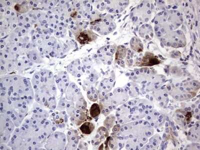 Immunohistochemistry: CEACAM5/CD66e Antibody (OTI3D8) [NBP2-46231]