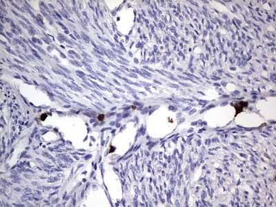Immunohistochemistry: CEACAM5/CD66e Antibody (OTI3D8) [NBP2-46231]