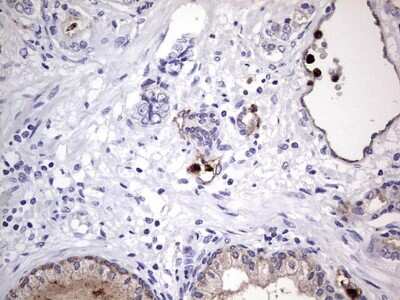 Immunohistochemistry: CEACAM5/CD66e Antibody (OTI3D8) [NBP2-46231]