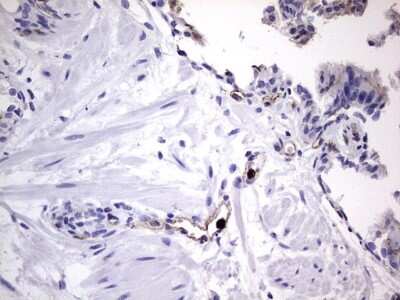 Immunohistochemistry: CEACAM5/CD66e Antibody (OTI3D8) [NBP2-46231]