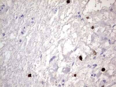 Immunohistochemistry: CEACAM5/CD66e Antibody (OTI3D8) [NBP2-46231]