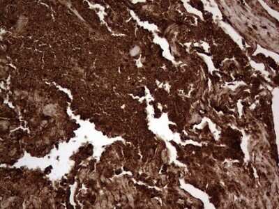 Immunohistochemistry: CEACAM5/CD66e Antibody (OTI3D8) [NBP2-46231]