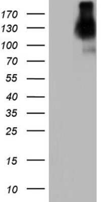 Western Blot: CEACAM5/CD66e Antibody (OTI3D8) [NBP2-46231]