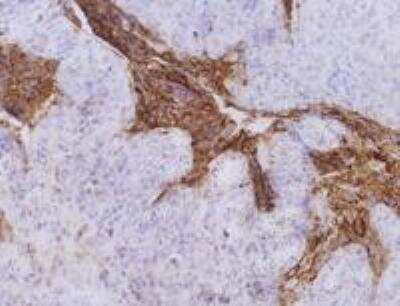 Immunohistochemistry-Paraffin: CEACAM5/CD66e Antibody (CB30) - BSA Free [NB110-58734]