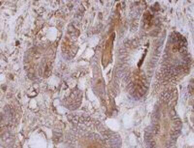 Immunohistochemistry-Paraffin: CEACAM5/CD66e Antibody (CB30) - BSA Free [NB110-58734]