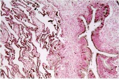 Immunohistochemistry: CEACAM6/CD66c Antibody (1H7-4B) - BSA Free [NBP2-54626]