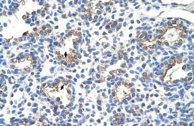 Immunohistochemistry-Paraffin: CEACAM6/CD66c Antibody [NBP1-55290]
