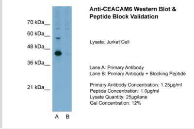 Western Blot: CEACAM6/CD66c Antibody [NBP1-55290]