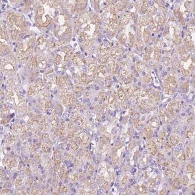 Immunohistochemistry-Paraffin: CEACAM7 Antibody [NBP2-39098]