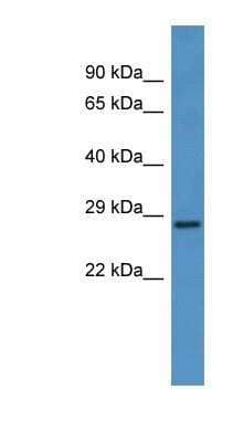 Western Blot: CEACAM7 Antibody [NBP1-68887]