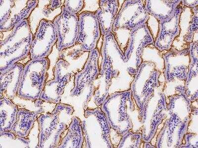 Immunohistochemistry-Frozen: CEACAM1/CD66a Antibody (030) [NBP2-90640]