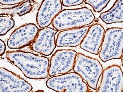 Immunohistochemistry-Paraffin: CEACAM1/CD66a Antibody (030) [NBP2-90640]