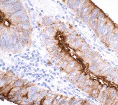 Immunohistochemistry-Paraffin: CEACAM1/CD66a Antibody (BLR032F) [NBP2-76405]