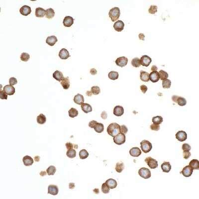 Immunocytochemistry: CEACAM1/CD66a Antibody (BLR032F) [NBP2-76405]