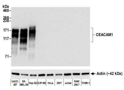 Western Blot: CEACAM1/CD66a Antibody (BLR032F) [NBP2-76405]