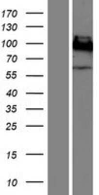 Western Blot: CEACAM1/CD66a Overexpression Lysate [NBP2-10255]