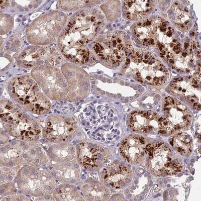 Immunohistochemistry-Paraffin: CEACAM16 Antibody [NBP1-91777]
