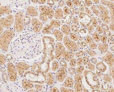 Immunohistochemistry-Paraffin: CEACAM16 Antibody [NBP3-06590]