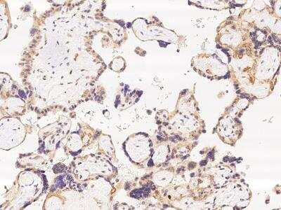 Immunohistochemistry-Paraffin: CEACAM16 Antibody [NBP3-06590]