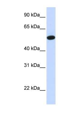 Western Blot: CEACAM16 Antibody [NBP1-70492]